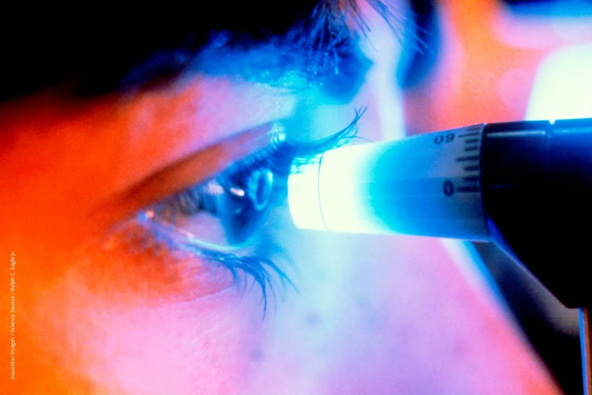 Patient bekommt den Augeninnendruck mit einem Goldmann-Ophthalmotonometer  gemessen.