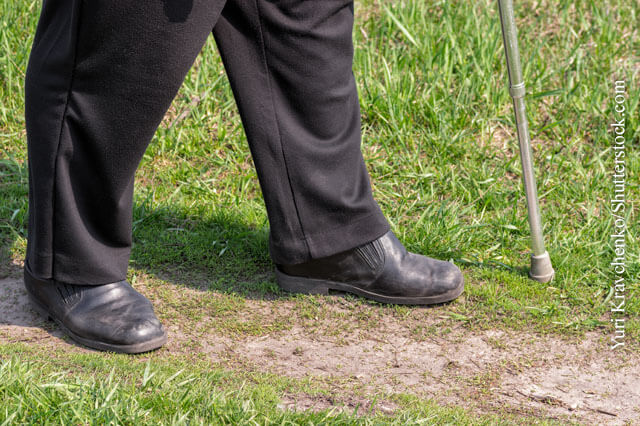 Amputationen bei Diabetikern