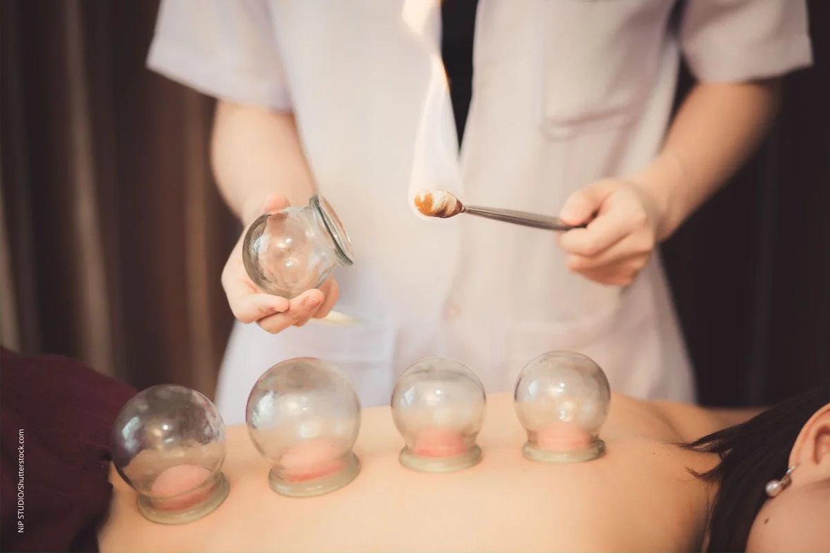 Therapeutin setzt Schröpfgläser auf dem Patientenrücken an. Das Schröpfen gehört zu den ausleitenden Verfahren und hat lange Tradition.
