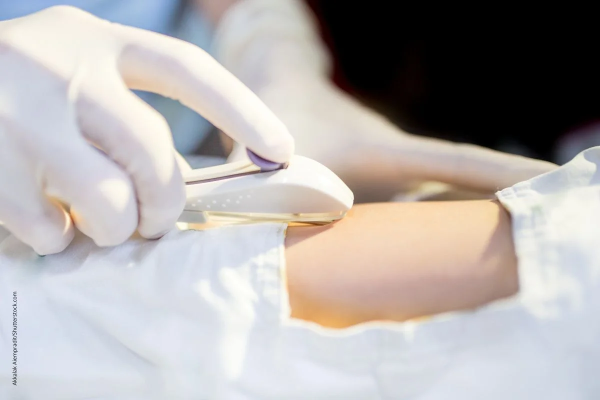 Injektion eines VerhÃ¼tungsstÃ¤bchens unter die Haut. Dabei wird grÃ¼ndlich auf die Hygiene geachtet