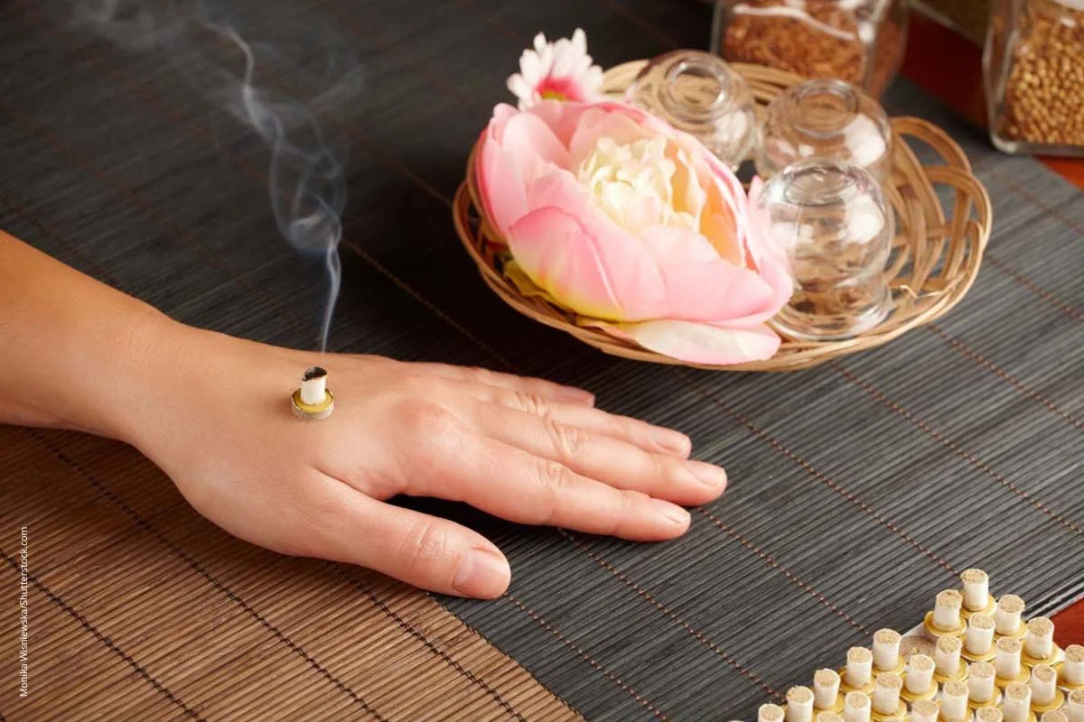 Röllchen mit glimmendem Heilkraut, das auf den HAndrücken einer Frau aufgesetzt ist. Die Reizung von Akupunkturpunkten durch glimmende Kräuter ist zentral in der Moxibustion.
