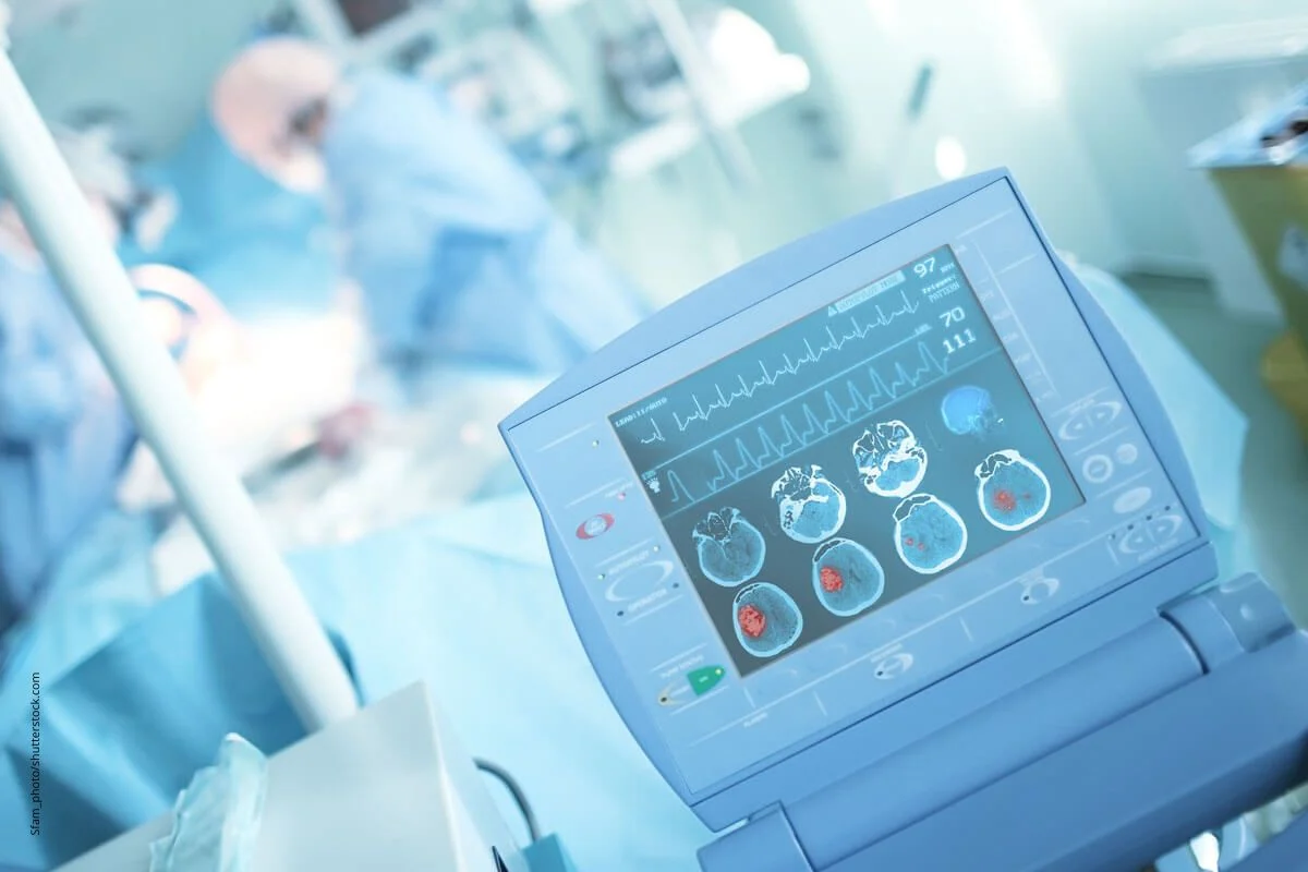 Monitor im Krankenhaus. Bei einem Schlaganfall tut sschnellstmÃ¶gliche Behandlung Not.