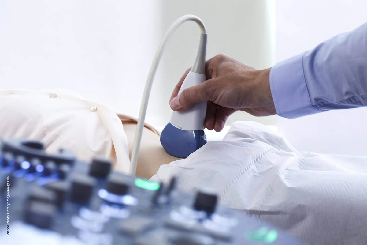 Durchführung eines Bauchultraschalls. Menstruationsstörungen können viele Ursachen haben, etliche lassen sich per Ultraschall feststellen.